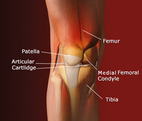 Knee Pain