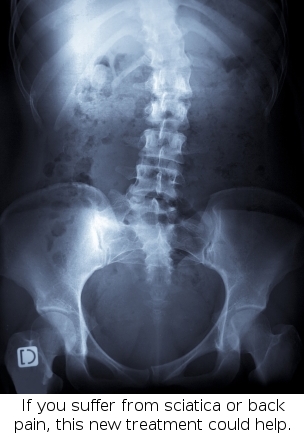 Could The Power Of Light  Heal Disc And Sciatica Pain?